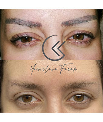 REVERSE -Remover PMU/Tattoo