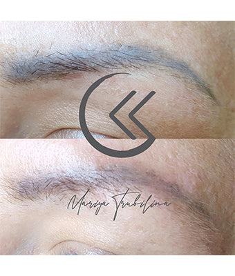REVERSE -Remover PMU/Tattoo