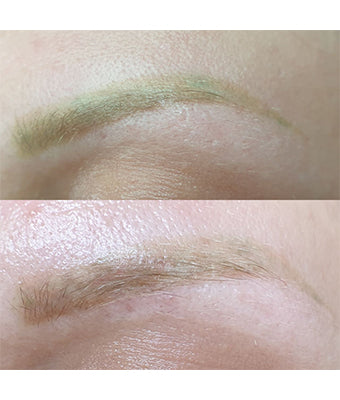 REVERSE -Remover PMU/Tattoo