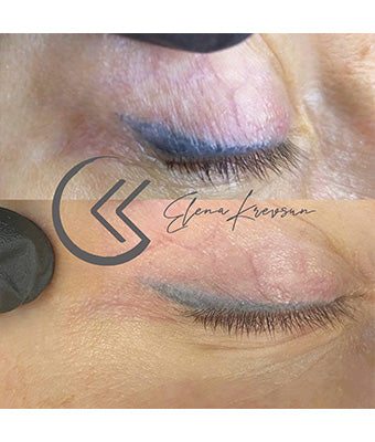 REVERSE -Remover PMU/Tattoo
