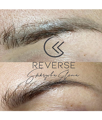 REVERSE -Remover PMU/Tattoo