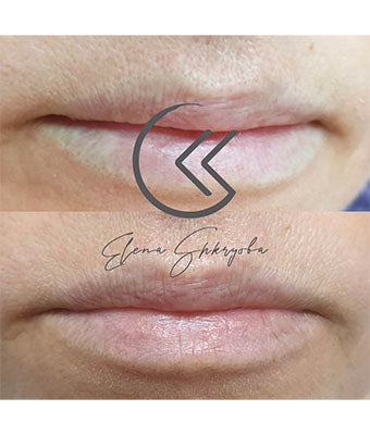 REVERSE -Remover PMU/Tattoo