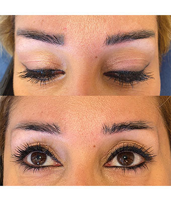 REVERSE -Remover PMU/Tattoo