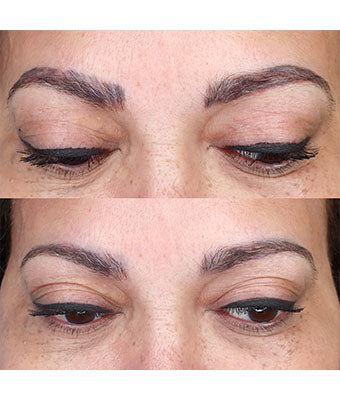 REVERSE -Remover PMU/Tattoo