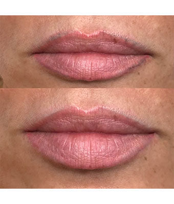 REVERSE -Remover PMU/Tattoo