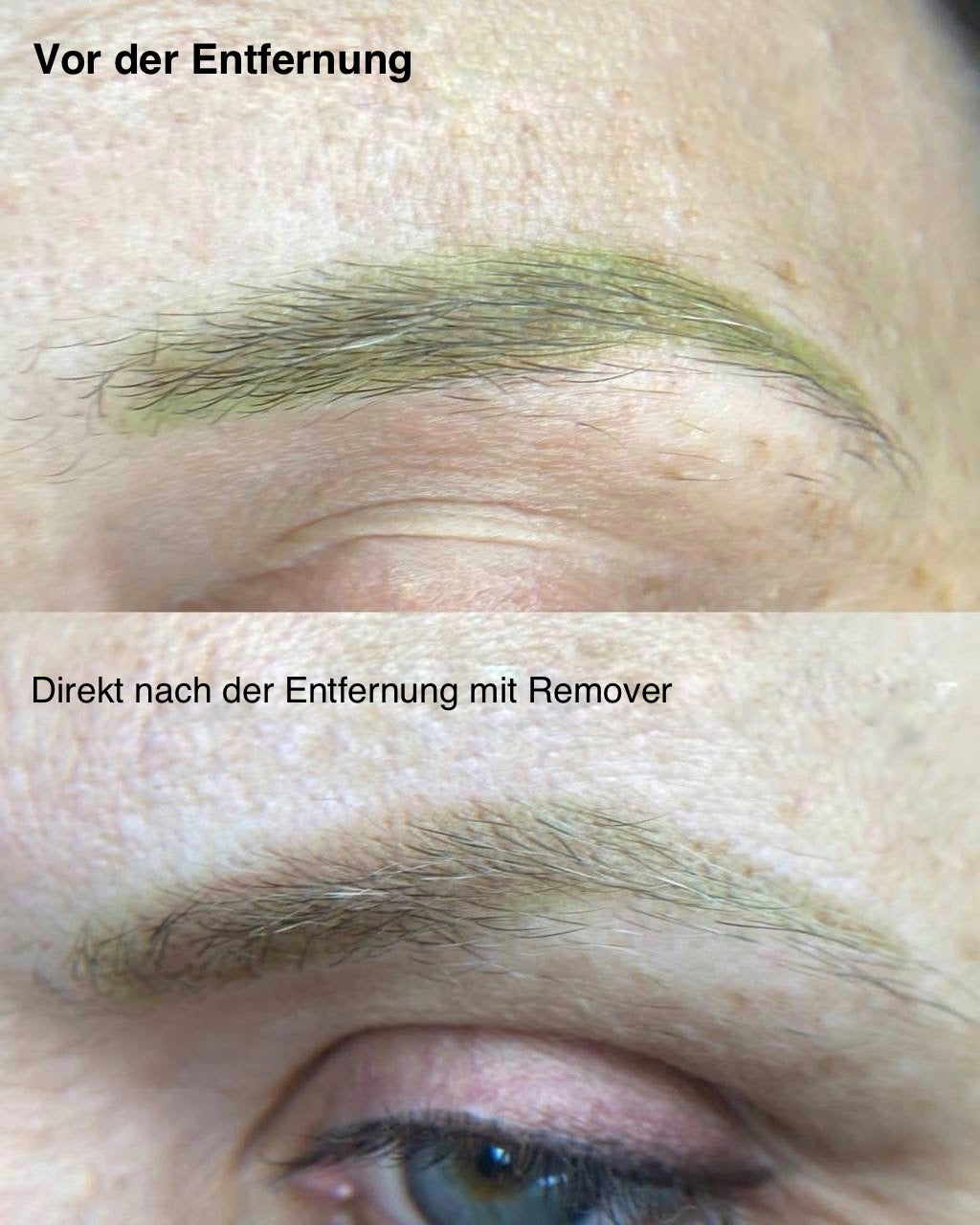 Etalon Mix Pigmentaufheller (Remover)